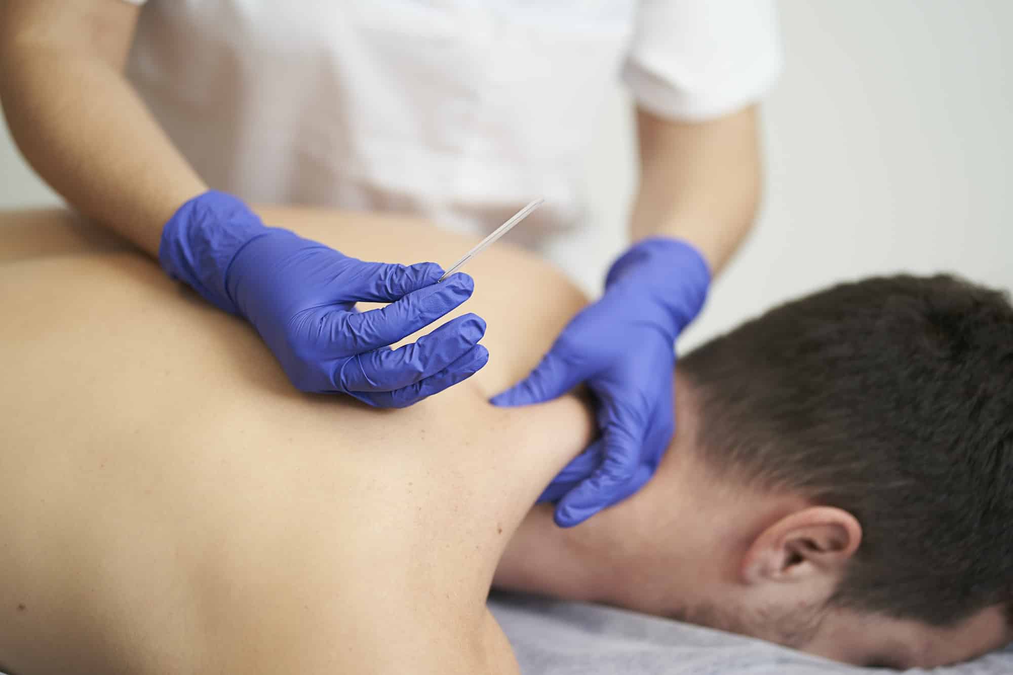 Dry Needling Spruce Grove | IMS Therapy | Sunrise Physio
